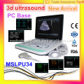 MSLPU34-I 2016 Latest PC base best ultrasound machine/3d ultrasound medical equipment